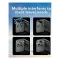 ONEMUST TC25 International Universal Travel Charger - 4